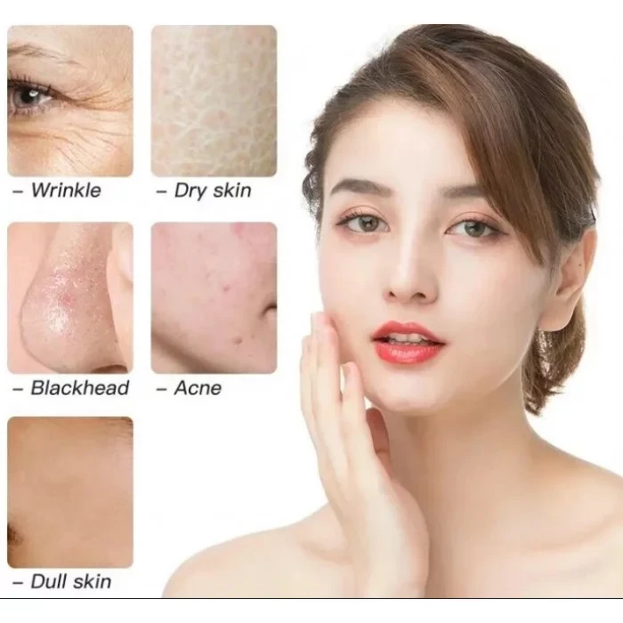 Паровая сауна для лица SOKANY